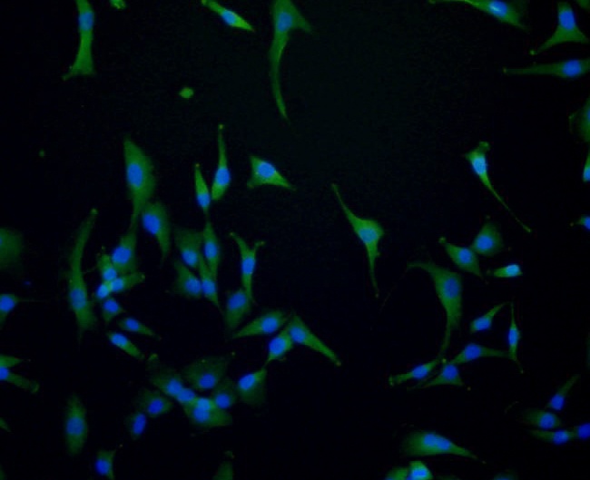 ICC staining EGFR in A172 cells (green). Formalin fixed cells were permeabilized with 0.1% Triton X-100 in TBS for 10 minutes at room temperature and blocked with 1% Blocker BSA for 15 minutes at room temperature. Cells were probed with the antibody (<a href="/products/0407-21" style="font-weight: bold;text-decoration: underline;">0407-21</a>) at a dilution of 1:100 for 1 hour at room temperature, washed with PBS. Alexa Fluorc&trade; 488 Goat anti-Rabbit IgG was used as the secondary antibody at 1/100 dilution. The nuclear counter stain is DAPI (blue).