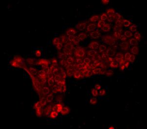 ICC staining of E-Cadherin in A431 cells (red). Formalin fixed cells were permeabilized with 0.1% Triton X-100 in TBS for 10 minutes at room temperature and blocked with 10% negative goat serum for 15 minutes at room temperature. Cells were probed with the primary antibody (<a href="/products/EM0502" style="font-weight: bold;text-decoration: underline;">EM0502</a>, 1/50) for 1 hour at room temperature, washed with PBS. Alexa Fluor&reg;555 conjugate-Goat anti-Mouse IgG was used as the secondary antibody at 1/1,000 dilution.