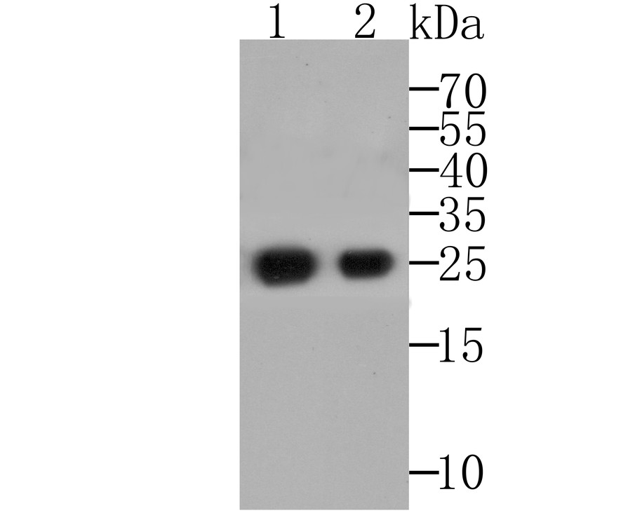 Anti-Alpha 1 Acid Glycoprotein Antibody [A2-B10]