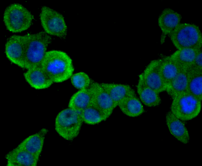 PCSK9 Mouse Monoclonal Antibody [2F2]