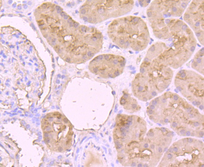 Immunohistochemical analysis of paraffin-embedded human kidney tissue using anti-L-FABP antibody. Counter stained with hematoxylin.