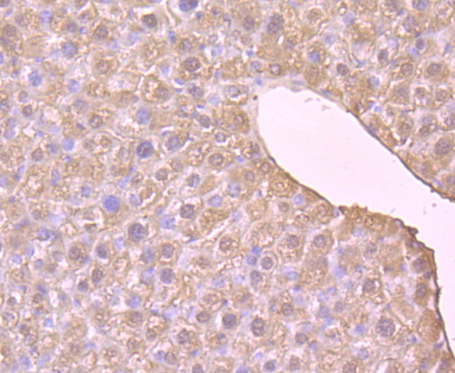 Immunohistochemical analysis of paraffin-embedded mouse liver tissue using anti-L-FABP antibody. Counter stained with hematoxylin.