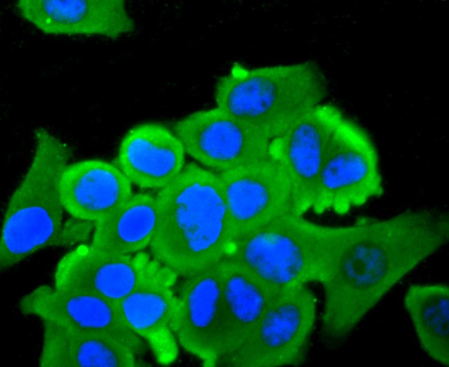 ICC staining L-FABP in A431 cells (green). The nuclear counter stain is DAPI (blue). Cells were fixed in paraformaldehyde, permeabilised with 0.25% Triton X100/PBS.