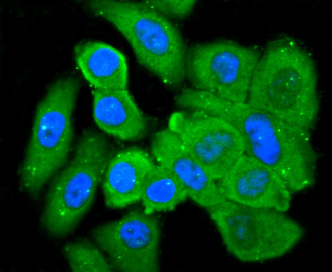 ICC staining L-FABP in HepG2 cells (green). The nuclear counter stain is DAPI (blue). Cells were fixed in paraformaldehyde, permeabilised with 0.25% Triton X100/PBS.
