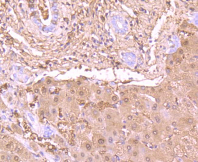 Immunohistochemical analysis of paraffin-embedded human liver tissue using anti-L-FABP antibody. Counter stained with hematoxylin.