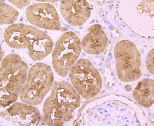 Immunohistochemical analysis of paraffin-embedded human kidney tissue using anti-L-FABP antibody. Counter stained with hematoxylin.