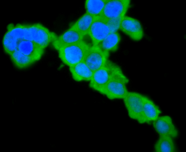 ICC staining L-FABP in 293T cells (green). The nuclear counter stain is DAPI (blue). Cells were fixed in paraformaldehyde, permeabilised with 0.25% Triton X100/PBS.