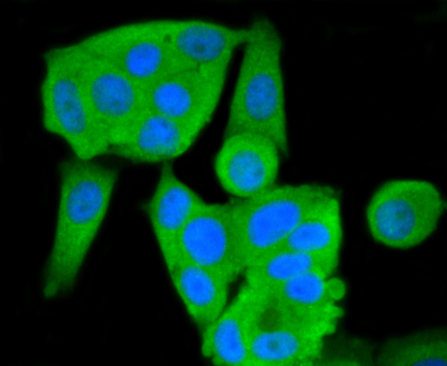ICC staining L-FABP in MCF-7 cells (green). The nuclear counter stain is DAPI (blue). Cells were fixed in paraformaldehyde, permeabilised with 0.25% Triton X100/PBS.