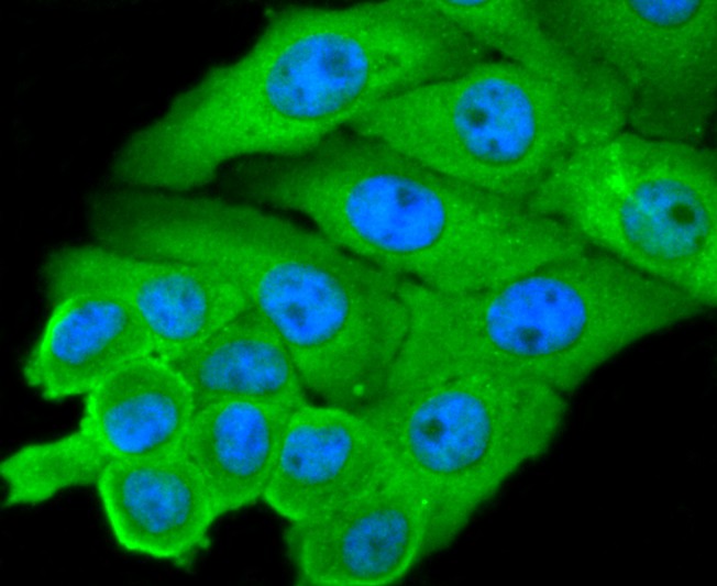 ICC staining L-FABP in HepG2 cells (green). The nuclear counter stain is DAPI (blue). Cells were fixed in paraformaldehyde, permeabilised with 0.25% Triton X100/PBS.