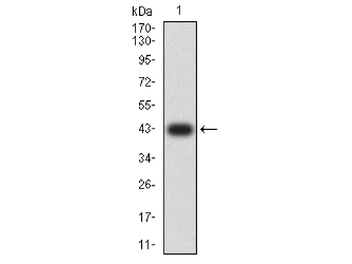 KMT2D Mouse Monoclonal Antibody [1D10F6]