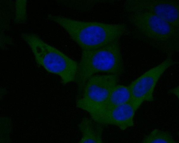 ICC staining of F13A1 in MCF-7 cells (green). Formalin fixed cells were permeabilized with 0.1% Triton X-100 in TBS for 10 minutes at room temperature and blocked with 1% Blocker BSA for 15 minutes at room temperature. Cells were probed with the primary antibody (<a href="/products/EM1901-39" style="font-weight: bold;text-decoration: underline;">EM1901-39</a>, 1/50) for 1 hour at room temperature, washed with PBS. Alexa Fluor&reg;488 Goat anti-Mouse IgG was used as the secondary antibody at 1/1,000 dilution. The nuclear counter stain is DAPI (blue).