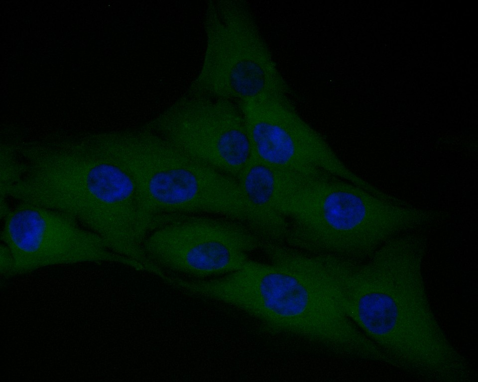 ICC staining of F13A1 in MG-63 cells (green). Formalin fixed cells were permeabilized with 0.1% Triton X-100 in TBS for 10 minutes at room temperature and blocked with 1% Blocker BSA for 15 minutes at room temperature. Cells were probed with the primary antibody (<a href="/products/EM1901-39" style="font-weight: bold;text-decoration: underline;">EM1901-39</a>, 1/50) for 1 hour at room temperature, washed with PBS. Alexa Fluor&reg;488 Goat anti-Mouse IgG was used as the secondary antibody at 1/1,000 dilution. The nuclear counter stain is DAPI (blue).