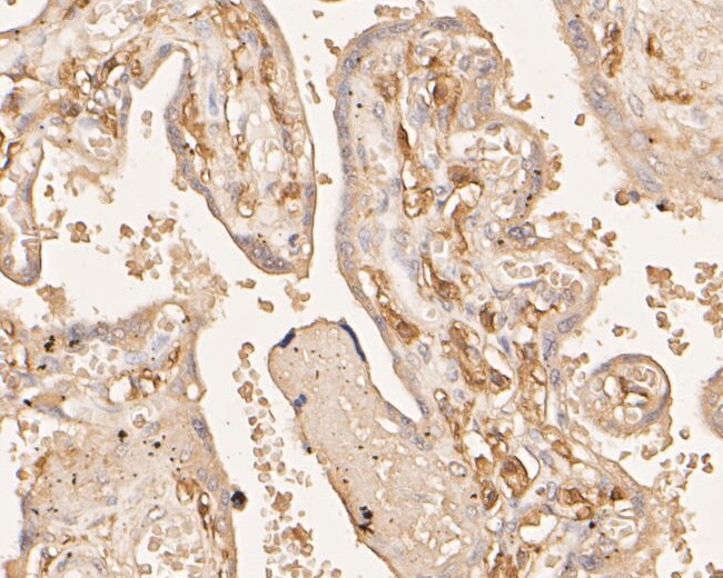 Immunohistochemical analysis of paraffin-embedded human placenta tissue using anti-F13A1 antibody. The section was pre-treated using heat mediated antigen retrieval with Tris-EDTA buffer (pH 8.0-8.4) for 20 minutes.The tissues were blocked in 5% BSA for 30 minutes at room temperature, washed with ddH<sub>2</sub>O and PBS, and then probed with the primary antibody (<a href="/products/EM1901-39" style="font-weight: bold;text-decoration: underline;">EM1901-39</a>, 1/800) for 30 minutes at room temperature. The detection was performed using an HRP conjugated compact polymer system. DAB was used as the chromogen. Tissues were counterstained with hematoxylin and mounted with DPX.