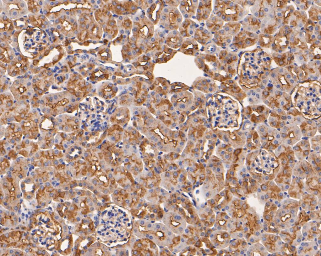 Immunohistochemical analysis of paraffin-embedded mouse kidney tissue using anti-Aspartate Aminotransferase antibody. The section was pre-treated using heat mediated antigen retrieval with Tris-EDTA buffer (pH 8.0-8.4) for 20 minutes.The tissues were blocked in 5% BSA for 30 minutes at room temperature, washed with ddH<sub>2</sub>O and PBS, and then probed with the primary antibody (<a href="/products/EM1901-50" style="font-weight: bold;text-decoration: underline;">EM1901-50</a>, 1/50) for 30 minutes at room temperature. The detection was performed using an HRP conjugated compact polymer system. DAB was used as the chromogen. Tissues were counterstained with hematoxylin and mounted with DPX.