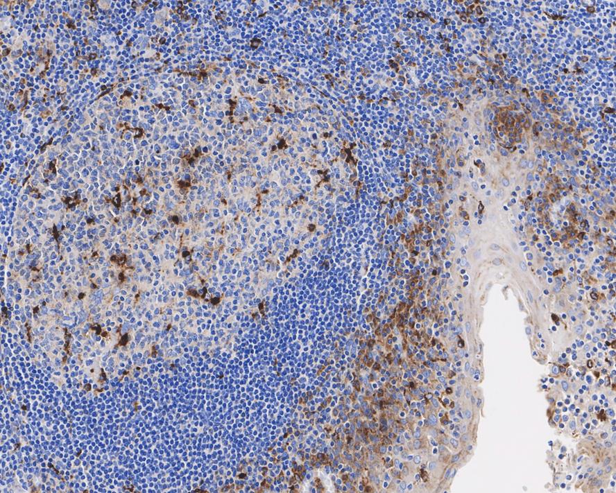 Immunohistochemical analysis of paraffin-embedded human tonsil tissue with Rabbit anti-CD68 antibody (<a href="/products/EM1901-95" style="font-weight: bold;text-decoration: underline;">EM1901-95</a>) at 1/1,000 dilution.<br /><br />The section was pre-treated using heat mediated antigen retrieval with Tris-EDTA buffer (pH 9.0) for 20 minutes. The tissues were blocked in 1% BSA for 20 minutes at room temperature, washed with ddH<sub>2</sub>O and PBS, and then probed with the primary antibody (<a href="/products/EM1901-95" style="font-weight: bold;text-decoration: underline;">EM1901-95</a>) at 1/1,000 dilution for 1 hour at room temperature. The detection was performed using an HRP conjugated compact polymer system. DAB was used as the chromogen. Tissues were counterstained with hematoxylin and mounted with DPX.
