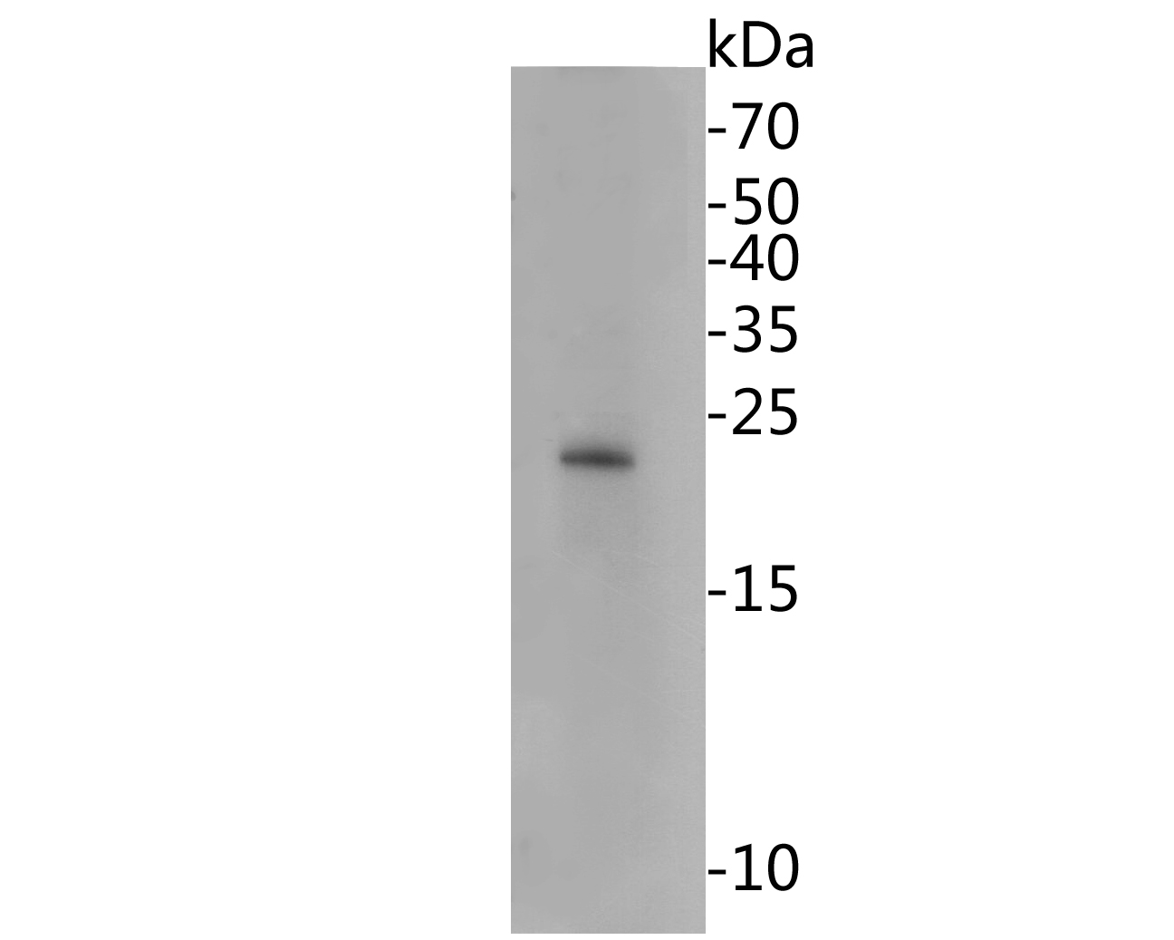 HMGB2 Mouse Monoclonal Antibody [10D1]