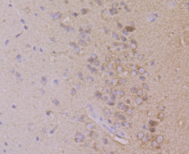 Immunohistochemical analysis of paraffin-embedded mouse brain tissue using anti-Dynamin 1 antibody. Counter stained with hematoxylin.