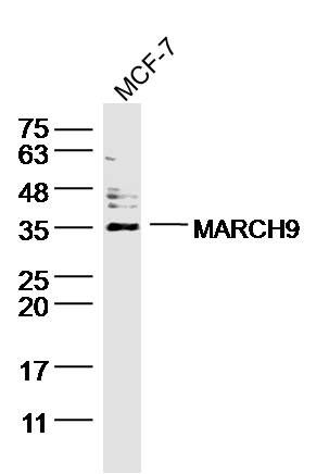 Sample: MCF-7 (human)cell Lysate at 40 ug<br />  Primary: Anti- MARCH9(ER1903-04)at 1/300 dilution<br />  Secondary: Goat Anti-Rabbit IgG at 1/20000 dilution<br />  Predicted band size: 38kD<br />  Observed band size: 38 kD<br />