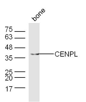 Sample: bone (Mouse) Lysate at 40 ug<br />  Primary: Anti-CENPL(ER1906-11) at 1/300 dilution<br />  Secondary: Goat Anti-Rabbit IgG at 1/20000 dilution<br />  Predicted band size: 39 kD<br />  Observed band size: 39 kD<br />