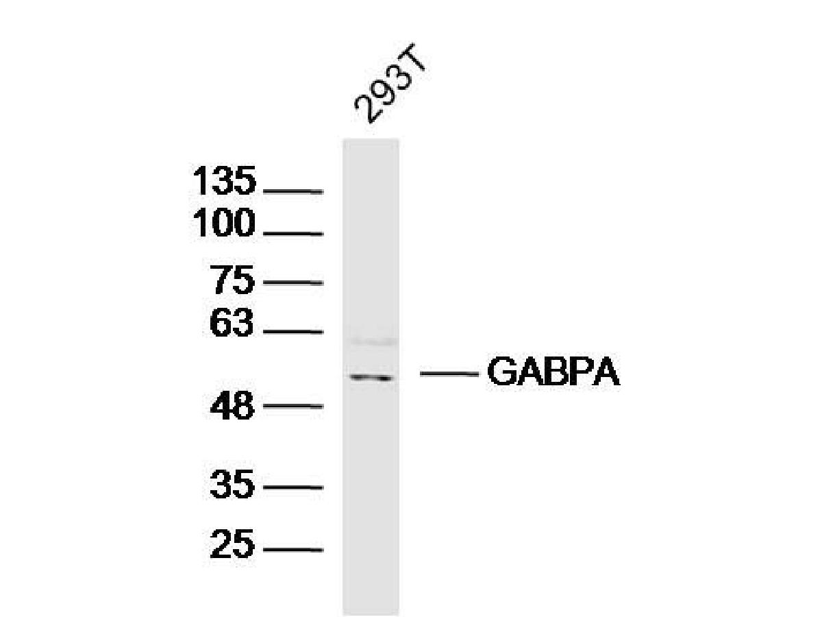 GABPA Rabbit Polyclonal Antibody