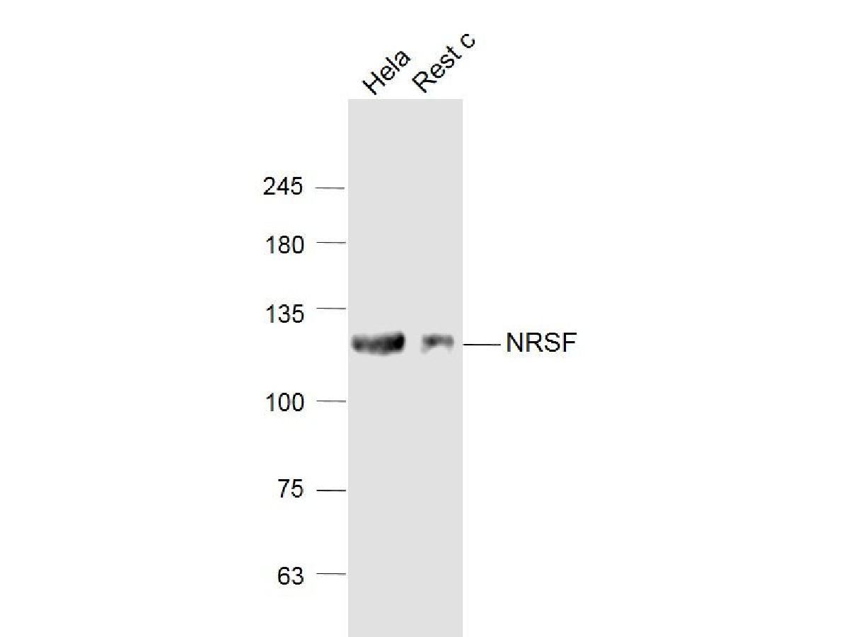 Sample: <br />  Hela(Human) Cell Lysate at 30 ug<br />  Rest c(Human) Cell Lysate at 30 ug<br />  Primary: Anti-NRSF (<a href="/products/ER1914-14" style="font-weight: bold;text-decoration: underline;">ER1914-14</a>) at 1/1000 dilution<br />  Secondary: Goat Anti-Rabbit IgG at 1/20000 dilution<br />  Predicted band size: 121 kD<br />  Observed band size: 121 kD<br />