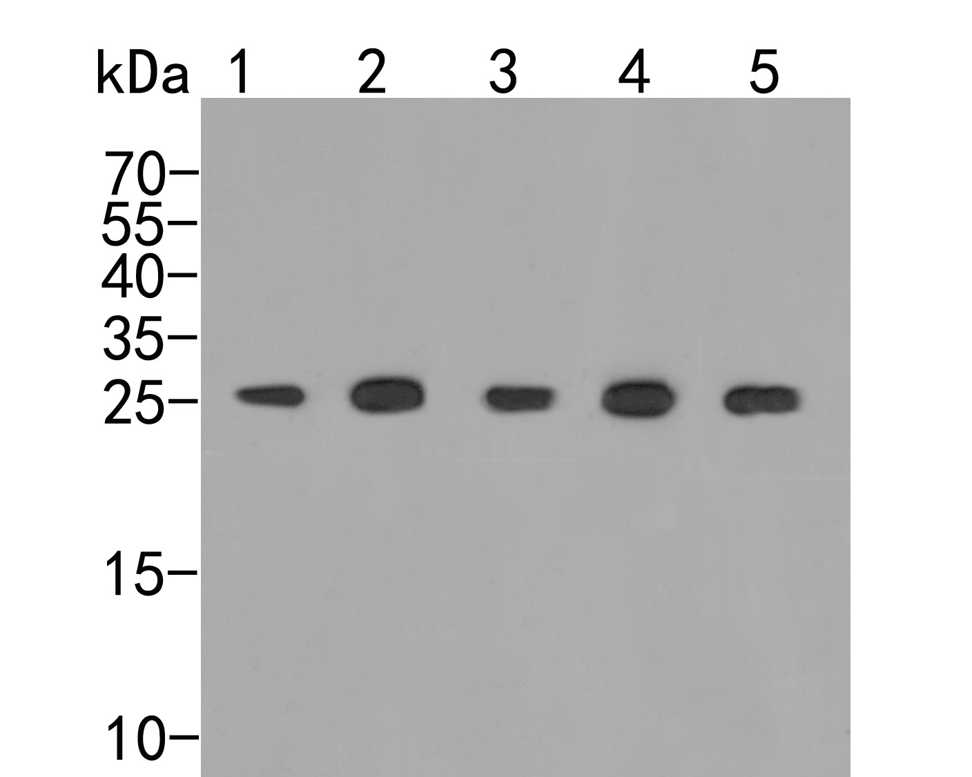 PSMA5 Rabbit Polyclonal Antibody
