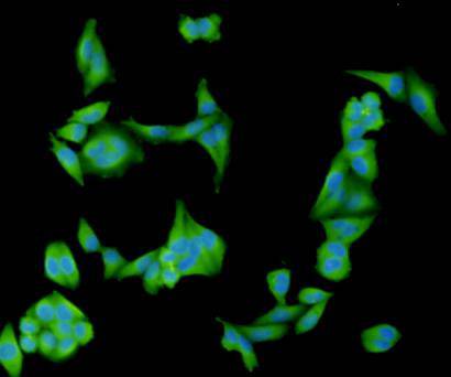 ICC staining of TGF beta 1 in Hela cells (green). Formalin fixed cells were permeabilized with 0.1% Triton X-100 in TBS for 10 minutes at room temperature and blocked with 10% negative goat serum for 15 minutes at room temperature. Cells were probed with the primary antibody (<a href="/products/ER31210" style="font-weight: bold;text-decoration: underline;">ER31210</a>, 1/50) for 1 hour at room temperature, washed with PBS. Alexa Fluor&reg;488 conjugate-Goat anti-Rabbit IgG was used as the secondary antibody at 1/1,000 dilution. The nuclear counter stain is DAPI (blue).