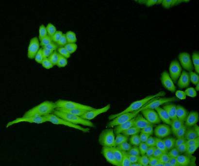 ICC staining of TGF beta 1 in HepG2 cells (green). Formalin fixed cells were permeabilized with 0.1% Triton X-100 in TBS for 10 minutes at room temperature and blocked with 10% negative goat serum for 15 minutes at room temperature. Cells were probed with the primary antibody (<a href="/products/ER31210" style="font-weight: bold;text-decoration: underline;">ER31210</a>, 1/50) for 1 hour at room temperature, washed with PBS. Alexa Fluor&reg;488 conjugate-Goat anti-Rabbit IgG was used as the secondary antibody at 1/1,000 dilution. The nuclear counter stain is DAPI (blue).