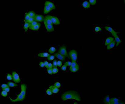ICC staining of TGF beta 1 in SK-Br-3 cells (green). Formalin fixed cells were permeabilized with 0.1% Triton X-100 in TBS for 10 minutes at room temperature and blocked with 10% negative goat serum for 15 minutes at room temperature. Cells were probed with the primary antibody (<a href="/products/ER31210" style="font-weight: bold;text-decoration: underline;">ER31210</a>, 1/50) for 1 hour at room temperature, washed with PBS. Alexa Fluor&reg;488 conjugate-Goat anti-Rabbit IgG was used as the secondary antibody at 1/1,000 dilution. The nuclear counter stain is DAPI (blue).