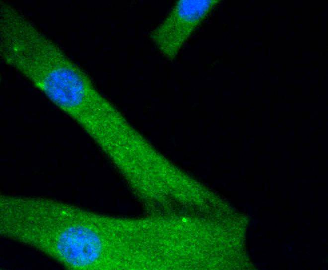 ICC staining of JNK1+JNK2+JNK3 in NIH/3T3 cells (green). Formalin fixed cells were permeabilized with 0.1% Triton X-100 in TBS for 10 minutes at room temperature and blocked with 1% Blocker BSA for 15 minutes at room temperature. Cells were probed with the primary antibody (<a href="/products/ET1601-28" style="font-weight: bold;text-decoration: underline;">ET1601-28</a>, 1/50) for 1 hour at room temperature, washed with PBS. Alexa Fluor&reg;488 Goat anti-Rabbit IgG was used as the secondary antibody at 1/1,000 dilution. The nuclear counter stain is DAPI (blue).