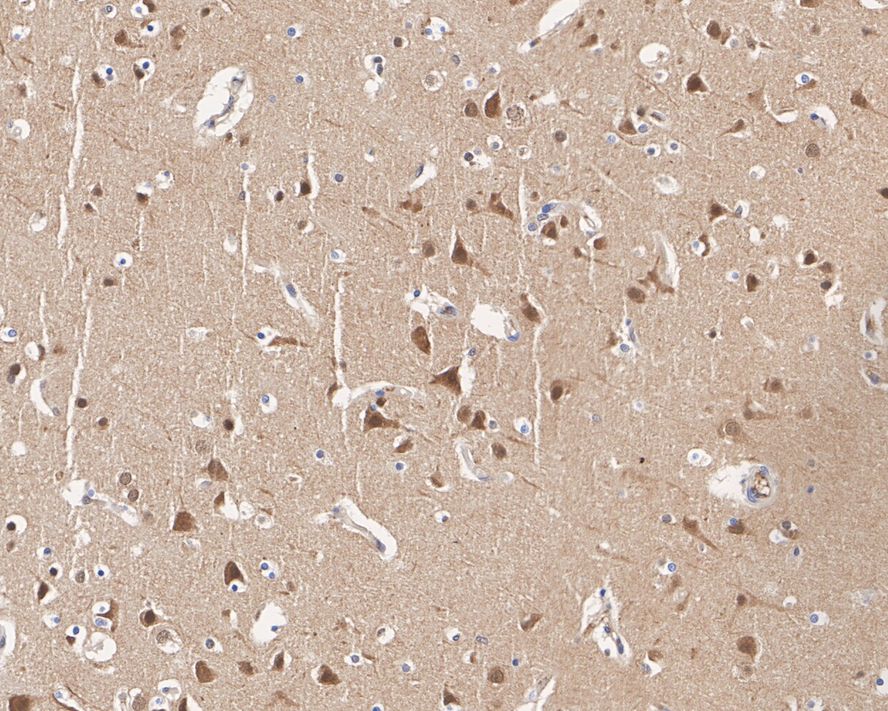 Immunohistochemical analysis of paraffin-embedded human brain tissue with Rabbit anti-JNK1+JNK2+JNK3 antibody (<a href="/products/ET1601-28" style="font-weight: bold;text-decoration: underline;">ET1601-28</a>) at 1/1,000 dilution.<br /><br />The section was pre-treated using heat mediated antigen retrieval with sodium citrate buffer (pH 6.0) for 2 minutes. The tissues were blocked in 1% BSA for 20 minutes at room temperature, washed with ddH<sub>2</sub>O and PBS, and then probed with the primary antibody (<a href="/products/ET1601-28" style="font-weight: bold;text-decoration: underline;">ET1601-28</a>) at 1/1,000 dilution for 1 hour at room temperature. The detection was performed using an HRP conjugated compact polymer system. DAB was used as the chromogen. Tissues were counterstained with hematoxylin and mounted with DPX.