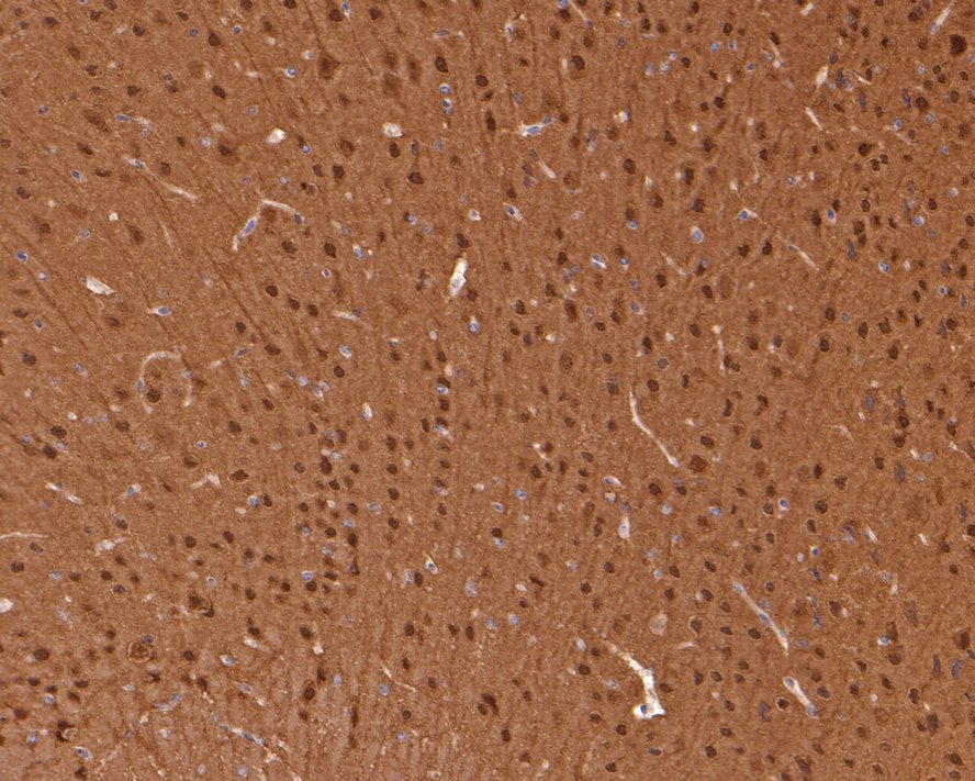 Immunohistochemical analysis of paraffin-embedded mouse brain tissue with Rabbit anti-JNK1+JNK2+JNK3 antibody (<a href="/products/ET1601-28" style="font-weight: bold;text-decoration: underline;">ET1601-28</a>) at 1/400 dilution.<br /><br />The section was pre-treated using heat mediated antigen retrieval with sodium citrate buffer (pH 6.0) for 2 minutes. The tissues were blocked in 1% BSA for 20 minutes at room temperature, washed with ddH<sub>2</sub>O and PBS, and then probed with the primary antibody (<a href="/products/ET1601-28" style="font-weight: bold;text-decoration: underline;">ET1601-28</a>) at 1/400 dilution for 1 hour at room temperature. The detection was performed using an HRP conjugated compact polymer system. DAB was used as the chromogen. Tissues were counterstained with hematoxylin and mounted with DPX.