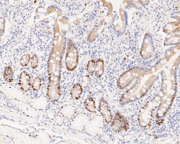 Immunohistochemical analysis of paraffin-embedded human small intestine tissue using anti-Cyclin D1 antibody. The section was pre-treated using heat mediated antigen retrieval with sodium citrate buffer (pH 6.0) for 2 minutes. The tissues were blocked in 5% BSA for 30 minutes at room temperature, washed with ddH<sub>2</sub>O and PBS, and then probed with the primary antibody (<a href="/products/ET1601-31" style="font-weight: bold;text-decoration: underline;">ET1601-31</a>, 1/200)  for 30 minutes at room temperature. The detection was performed using an HRP conjugated compact polymer system. DAB was used as the chromogen. Tissues were counterstained with hematoxylin and mounted with DPX.