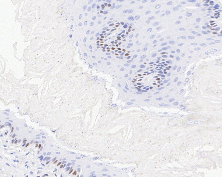 Immunohistochemical analysis of paraffin-embedded rat esophagus tissue with Rabbit anti-Cyclin D1 antibody (<a href="/products/ET1601-31" style="font-weight: bold;text-decoration: underline;">ET1601-31</a>) at 1/1,000 dilution.<br /><br />The section was pre-treated using heat mediated antigen retrieval with sodium citrate buffer (pH 6.0) for 2 minutes. The tissues were blocked in 1% BSA for 20 minutes at room temperature, washed with ddH<sub>2</sub>O and PBS, and then probed with the primary antibody (<a href="/products/ET1601-31" style="font-weight: bold;text-decoration: underline;">ET1601-31</a>) at 1/1,000 dilution for 1 hour at room temperature. The detection was performed using an HRP conjugated compact polymer system. DAB was used as the chromogen. Tissues were counterstained with hematoxylin and mounted with DPX.