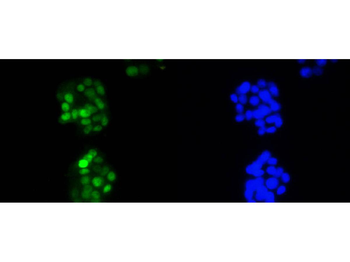 ICC staining of Cyclin D1 in PC-12 cells (green). Formalin fixed cells were permeabilized with 0.1% Triton X-100 in TBS for 10 minutes at room temperature and blocked with 1% Blocker BSA for 15 minutes at room temperature. Cells were probed with the primary antibody (<a href="/products/ET1601-31" style="font-weight: bold;text-decoration: underline;">ET1601-31</a>, 1/50) for 1 hour at room temperature, washed with PBS. Alexa Fluor&reg;488 Goat anti-Rabbit IgG was used as the secondary antibody at 1/1,000 dilution. The nuclear counter stain is DAPI (blue).