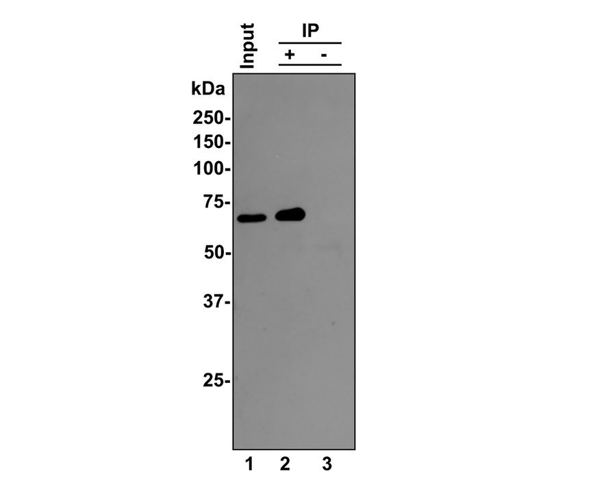 NF-κB p65 was immunoprecipitated from 0.5 mg Hela whole cell lysates with <a href="/products/ET1603-12" style="font-weight: bold;text-decoration: underline;">ET1603-12</a> at 2 μg/mL. Western blot was performed from the immunoprecipitate using <a href="/products/ET1603-12" style="font-weight: bold;text-decoration: underline;">ET1603-12</a> at 1/500 dilution for 45 minutes at room temperature. Goat anti-Rabbit IgG-HRP Secondary Antibody (<a href="/products/HA1001" style="font-weight: bold;text-decoration: underline;">HA1001</a>) was used at 1:300,000 dilution for 30 minutes at room temperature.<br /><br />Lane 1: Hela whole cell lysates at 10 μg;<br />Lane 2: NF-κB p65 (<a href="/products/ET1603-12" style="font-weight: bold;text-decoration: underline;">ET1603-12</a>) IP in Hela whole cell lysates;<br />Lane 3: Rabbit IgG instead of NF-κB p65 (<a href="/products/ET1603-12" style="font-weight: bold;text-decoration: underline;">ET1603-12</a>) in Hela whole cell lysates.<br /><br />Predicted band size: 60 kDa<br />Observed band size: 65 kDa<br /><br />Exposure time: 10 seconds;<br /><br />8% SDS-PAGE gel.