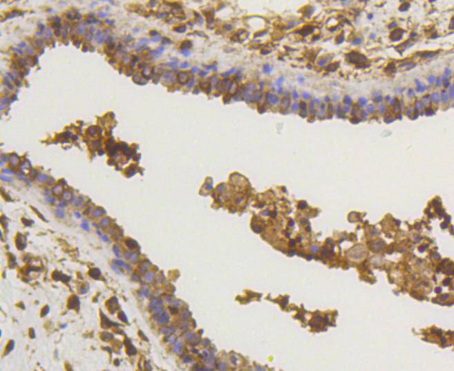 Immunohistochemical analysis of paraffin-embedded human spleen tissue with Rabbit anti-NF-κB p65 antibody (<a href="/products/ET1603-12" style="font-weight: bold;text-decoration: underline;">ET1603-12</a>) at 1/200 dilution.<br /><br />The section was pre-treated using heat mediated antigen retrieval with sodium citrate buffer (pH 6.0) for 2 minutes. The tissues were blocked in 1% BSA for 20 minutes at room temperature, washed with ddH<sub>2</sub>O and PBS, and then probed with the primary antibody (<a href="/products/ET1603-12" style="font-weight: bold;text-decoration: underline;">ET1603-12</a>) at 1/200 dilution for 1 hour at room temperature. The detection was performed using an HRP conjugated compact polymer system. DAB was used as the chromogen. Tissues were counterstained with hematoxylin and mounted with DPX.