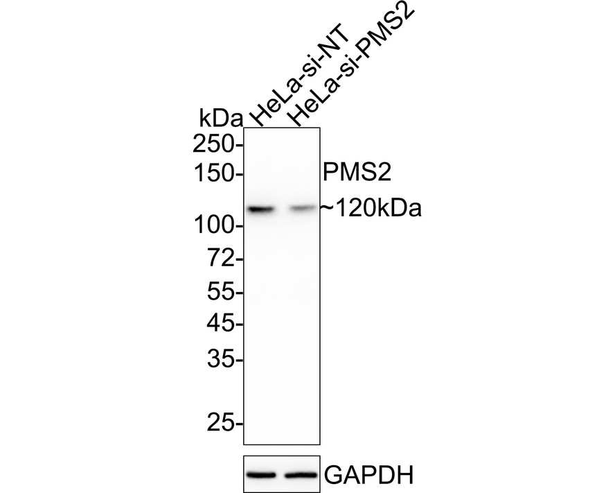 Western blot analysis of PMS2 on different lysates with Rabbit anti-PMS2 antibody (<a href="/products/ET1605-1" style="font-weight: bold;text-decoration: underline;">ET1605-1</a>) at 1/5,000 dilution.<br /><br />Lane 1: HeLa-si NT cell lysate<br />Lane 2: HeLa-si PMS2 cell lysate<br /><br />Lysates/proteins at 10 µg/Lane.<br /><br />Predicted band size: 96 kDa<br />Observed band size: 120 kDa<br /><br />Exposure time: 1 minute; ECL: K1801;<br /><br />4-20% SDS-PAGE gel.<br /><br />Proteins were transferred to a PVDF membrane and blocked with 5% NFDM/TBST for 1 hour at room temperature. The primary antibody (<a href="/products/ET1605-1" style="font-weight: bold;text-decoration: underline;">ET1605-1</a>) at 1/5,000 dilution was used in 5% NFDM/TBST at 4℃ overnight. Goat Anti-Rabbit IgG - HRP Secondary Antibody (<a href="/products/HA1001" style="font-weight: bold;text-decoration: underline;">HA1001</a>) at 1/50,000 dilution was used for 1 hour at room temperature.