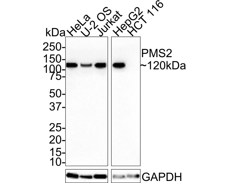 Western blot analysis of PMS2 on different lysates with Rabbit anti-PMS2 antibody (<a href="/products/ET1605-1" style="font-weight: bold;text-decoration: underline;">ET1605-1</a>) at 1/2,000 dilution.<br /><br />Lane 1: HeLa cell lysate<br />Lane 2: U-2 OS cell lysate<br />Lane 3: Jurkat cell lysate<br />Lane 4: HepG2 cell lysate<br />Lane 5: HCT 116 cell lysate (negative)<br /><br />Lysates/proteins at 20 µg/Lane.<br /><br />Predicted band size: 96 kDa<br />Observed band size: 120 kDa<br /><br />Exposure time: 37 seconds;<br /><br />4-20% SDS-PAGE gel.<br /><br />Proteins were transferred to a PVDF membrane and blocked with 5% NFDM/TBST for 1 hour at room temperature. The primary antibody (<a href="/products/ET1605-1" style="font-weight: bold;text-decoration: underline;">ET1605-1</a>) at 1/2,000 dilution was used in 5% NFDM/TBST at room temperature for 2 hours. Goat Anti-Rabbit IgG - HRP Secondary Antibody (<a href="/products/HA1001" style="font-weight: bold;text-decoration: underline;">HA1001</a>) at 1:100,000 dilution was used for 1 hour at room temperature.