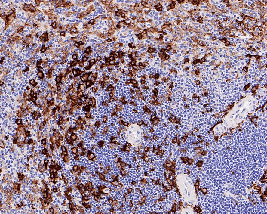Immunohistochemical analysis of paraffin-embedded human spleen tissue with Rabbit anti-CD11c antibody (<a href="/products/ET1606-19" style="font-weight: bold;text-decoration: underline;">ET1606-19</a>) at 1/500 dilution.<br /><br />The section was pre-treated using heat mediated antigen retrieval with Tris-EDTA buffer (pH 9.0) for 20 minutes. The tissues were blocked in 1% BSA for 20 minutes at room temperature, washed with ddH<sub>2</sub>O and PBS, and then probed with the primary antibody (<a href="/products/ET1606-19" style="font-weight: bold;text-decoration: underline;">ET1606-19</a>) at 1/500 dilution for 1 hour at room temperature. The detection was performed using an HRP conjugated compact polymer system. DAB was used as the chromogen. Tissues were counterstained with hematoxylin and mounted with DPX.