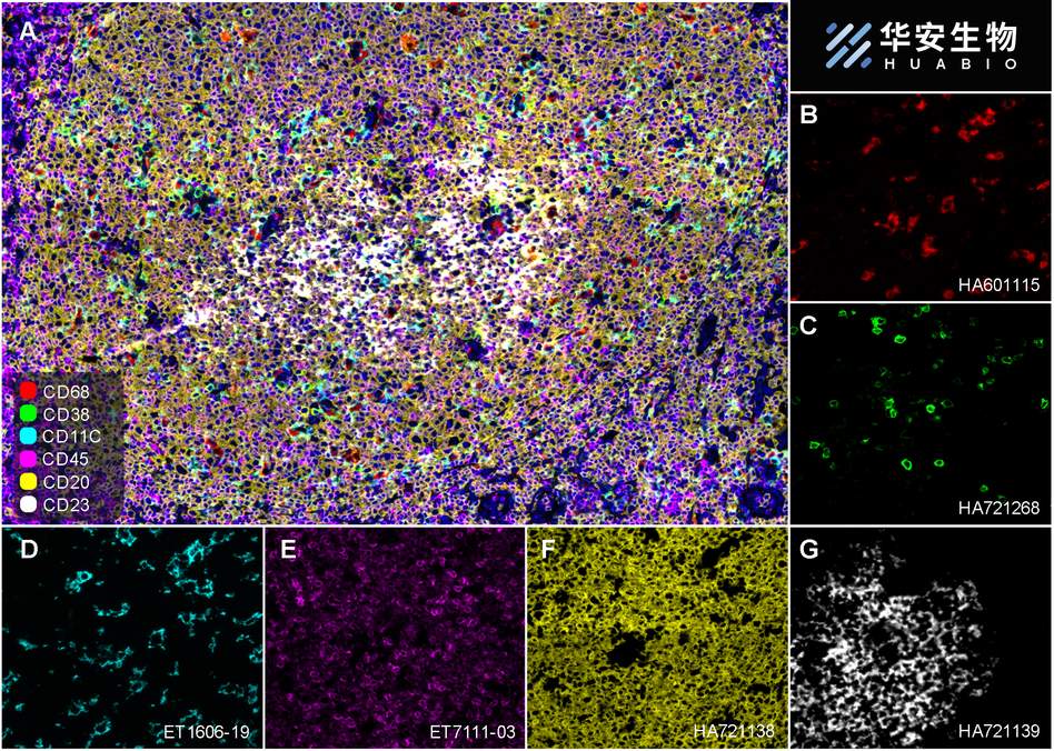 Fluorescence multiplex immunohistochemical analysis of Human tonsil (Formalin/PFA-fixed paraffin-embedded sections). Panel A: the merged image of anti-CD68 (<a href="/products/HA601115" style="font-weight: bold;text-decoration: underline;">HA601115</a>, Red), anti-CD38 (<a href="/products/HA721268" style="font-weight: bold;text-decoration: underline;">HA721268</a>, Green), anti-CD23 (<a href="/products/HA721139" style="font-weight: bold;text-decoration: underline;">HA721139</a>, White), anti-CD11C (<a href="/products/ET1606-19" style="font-weight: bold;text-decoration: underline;">ET1606-19</a>, Cyan), anti-CD45 (<a href="/products/ET7111-03" style="font-weight: bold;text-decoration: underline;">ET7111-03</a>, Magenta) and anti-CD20 (<a href="/products/HA721138" style="font-weight: bold;text-decoration: underline;">HA721138</a>, Yellow) on tonsil. Panel B: anti-CD68 stained on Macrophage. Panel C: anti-CD38 stained on lymphocyte subsets. Panel D: anti-CD11C stained on dendritic cells. Panel E: CD45 stained on lymphocytes. Panel F: anti-CD20 stained on B cells. Panel G: anti-CD23 stained on follicular dendritic cells. HRP Conjugated UltraPolymer Goat Polyclonal Antibody HA1119/HA1120 was used as a secondary antibody. The immunostaining was performed with the Sequential Immuno-staining Kit (IRISKit&trade;MH010101, www.luminiris.cn). The section was incubated in six rounds of staining: in the order of <a href="/products/HA601115" style="font-weight: bold;text-decoration: underline;">HA601115</a> (1/2,000 dilution), <a href="/products/HA721268" style="font-weight: bold;text-decoration: underline;">HA721268</a> (1/1,000 dilution), <a href="/products/ET1606-19" style="font-weight: bold;text-decoration: underline;">ET1606-19</a> (1/1,000 dilution), <a href="/products/ET7111-03" style="font-weight: bold;text-decoration: underline;">ET7111-03</a> (1/500 dilution), <a href="/products/HA721138" style="font-weight: bold;text-decoration: underline;">HA721138</a> (1/2,000 dilution) and <a href="/products/HA721139" style="font-weight: bold;text-decoration: underline;">HA721139</a> (1/800 dilution) for 20 mins at room temperature. Each round was followed by a separate fluorescent tyramide signal amplification system. Heat mediated antigen retrieval with Tris-EDTA buffer (pH 9.0) for 30 mins at 95℃. DAPI (blue) was used as a nuclear counter stain. Image acquisition was performed with Olympus VS200 Slide Scanner.