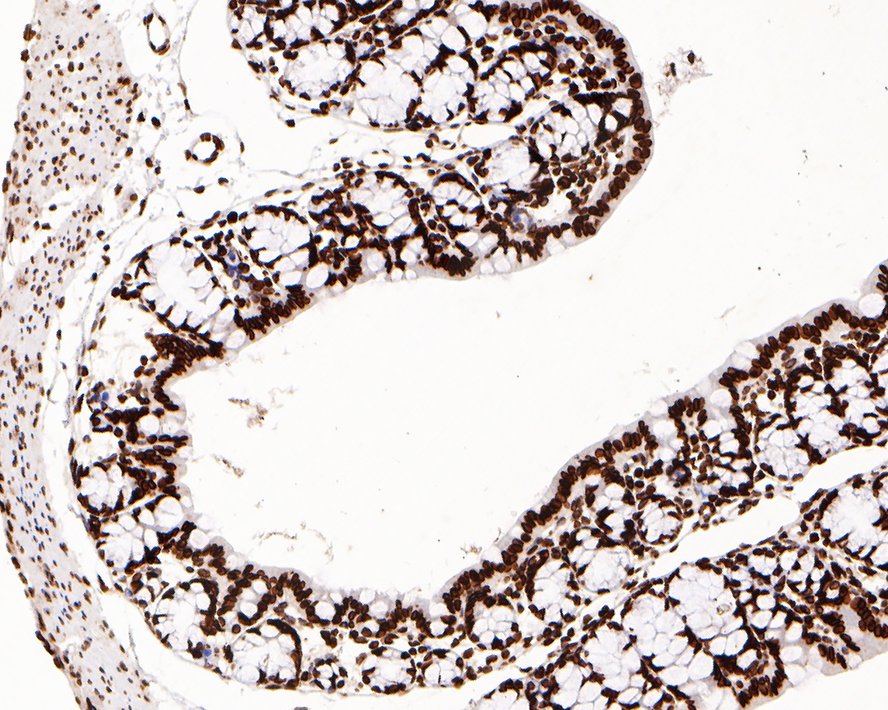 Immunohistochemical analysis of paraffin-embedded mouse large intestine tissue with Rabbit anti-Lamin B1 antibody (<a href="/products/ET1606-27" style="font-weight: bold;text-decoration: underline;">ET1606-27</a>) at 1/500 dilution.<br /><br />The section was pre-treated using heat mediated antigen retrieval with sodium citrate buffer (pH 6.0) for 2 minutes. The tissues were blocked in 1% BSA for 20 minutes at room temperature, washed with ddH<sub>2</sub>O and PBS, and then probed with the primary antibody (<a href="/products/ET1606-27" style="font-weight: bold;text-decoration: underline;">ET1606-27</a>) at 1/500 dilution for 1 hour at room temperature. The detection was performed using an HRP conjugated compact polymer system. DAB was used as the chromogen. Tissues were counterstained with hematoxylin and mounted with DPX.