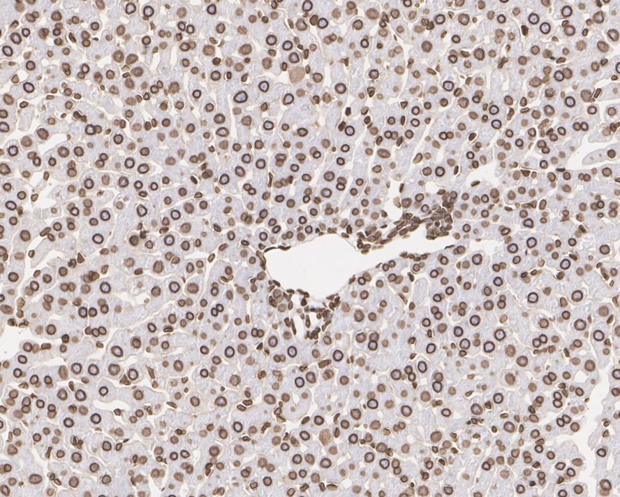 Immunohistochemical analysis of paraffin-embedded rat liver tissue with Rabbit anti-Lamin B1 antibody (<a href="/products/ET1606-27" style="font-weight: bold;text-decoration: underline;">ET1606-27</a>) at 1/1,000 dilution.<br /><br />The section was pre-treated using heat mediated antigen retrieval with Tris-EDTA buffer (pH 9.0) for 20 minutes. The tissues were blocked in 1% BSA for 20 minutes at room temperature, washed with ddH<sub>2</sub>O and PBS, and then probed with the primary antibody (<a href="/products/ET1606-27" style="font-weight: bold;text-decoration: underline;">ET1606-27</a>) at 1/1,000 dilution for 1 hour at room temperature. The detection was performed using an HRP conjugated compact polymer system. DAB was used as the chromogen. Tissues were counterstained with hematoxylin and mounted with DPX.