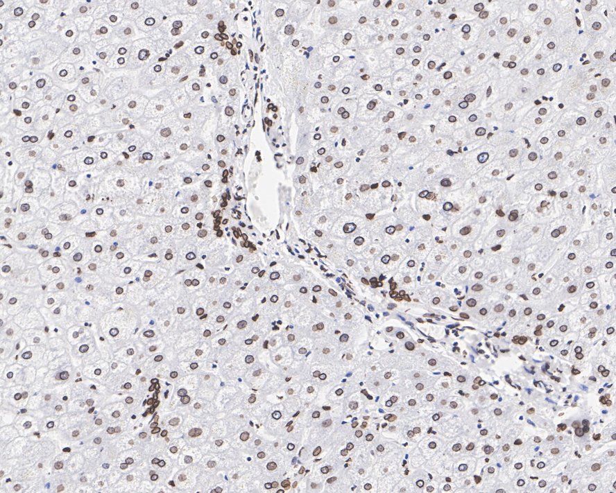 Immunohistochemical analysis of paraffin-embedded human liver tissue with Rabbit anti-Lamin B1 antibody (<a href="/products/ET1606-27" style="font-weight: bold;text-decoration: underline;">ET1606-27</a>) at 1/1,000 dilution.<br /><br />The section was pre-treated using heat mediated antigen retrieval with Tris-EDTA buffer (pH 9.0) for 20 minutes. The tissues were blocked in 1% BSA for 20 minutes at room temperature, washed with ddH<sub>2</sub>O and PBS, and then probed with the primary antibody (<a href="/products/ET1606-27" style="font-weight: bold;text-decoration: underline;">ET1606-27</a>) at 1/1,000 dilution for 1 hour at room temperature. The detection was performed using an HRP conjugated compact polymer system. DAB was used as the chromogen. Tissues were counterstained with hematoxylin and mounted with DPX.
