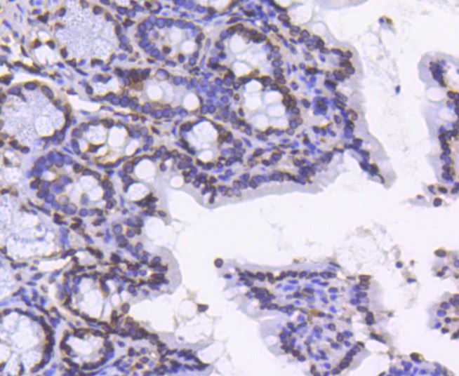 Immunohistochemical analysis of paraffin-embedded mouse colon tissue using anti-Lamin B1 antibody. The section was pre-treated using heat mediated antigen retrieval with Tris-EDTA buffer (pH 8.0-8.4) for 20 minutes.The tissues were blocked in 5% BSA for 30 minutes at room temperature, washed with ddH<sub>2</sub>O and PBS, and then probed with the primary antibody (<a href="/products/ET1606-27" style="font-weight: bold;text-decoration: underline;">ET1606-27</a>, 1/50) for 30 minutes at room temperature. The detection was performed using an HRP conjugated compact polymer system. DAB was used as the chromogen. Tissues were counterstained with hematoxylin and mounted with DPX.