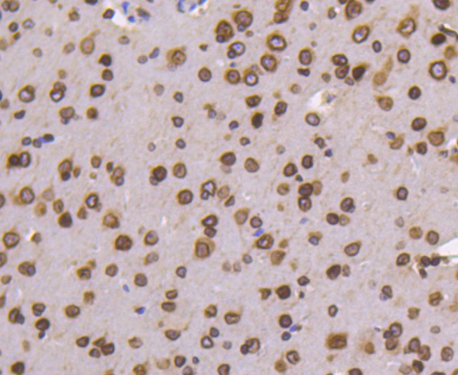 Immunohistochemical analysis of paraffin-embedded mouse brain tissue using anti-Lamin B1 antibody. The section was pre-treated using heat mediated antigen retrieval with Tris-EDTA buffer (pH 8.0-8.4) for 20 minutes.The tissues were blocked in 5% BSA for 30 minutes at room temperature, washed with ddH<sub>2</sub>O and PBS, and then probed with the primary antibody (<a href="/products/ET1606-27" style="font-weight: bold;text-decoration: underline;">ET1606-27</a>, 1/50) for 30 minutes at room temperature. The detection was performed using an HRP conjugated compact polymer system. DAB was used as the chromogen. Tissues were counterstained with hematoxylin and mounted with DPX.