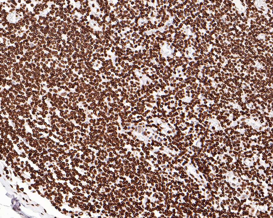 Immunohistochemical analysis of paraffin-embedded human lymph nodes tissue with Rabbit anti-Lamin B1 antibody (<a href="/products/ET1606-27" style="font-weight: bold;text-decoration: underline;">ET1606-27</a>) at 1/500 dilution.<br /><br />The section was pre-treated using heat mediated antigen retrieval with sodium citrate buffer (pH 6.0) for 2 minutes. The tissues were blocked in 1% BSA for 20 minutes at room temperature, washed with ddH<sub>2</sub>O and PBS, and then probed with the primary antibody (<a href="/products/ET1606-27" style="font-weight: bold;text-decoration: underline;">ET1606-27</a>) at 1/500 dilution for 1 hour at room temperature. The detection was performed using an HRP conjugated compact polymer system. DAB was used as the chromogen. Tissues were counterstained with hematoxylin and mounted with DPX.