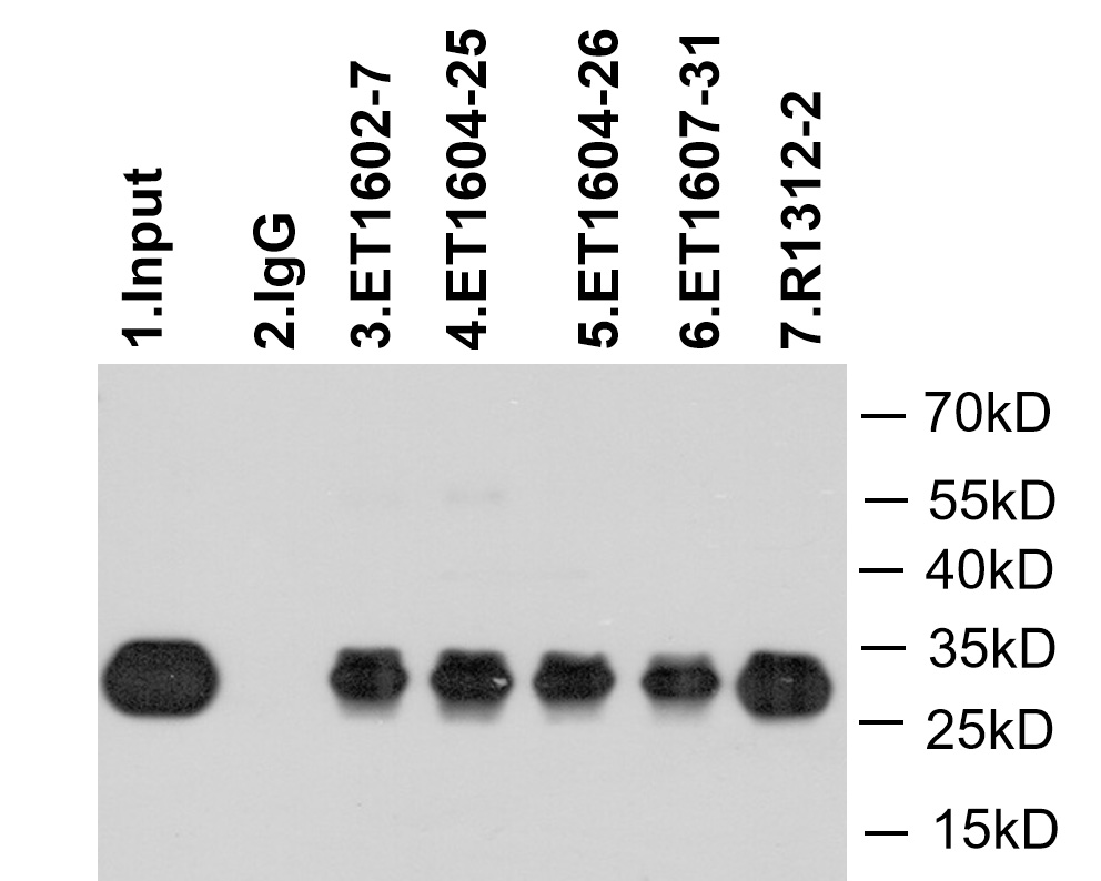 GFP tag was immunoprecipitated in 5µg GFP Tag fusion protein lysate with <a href="/products/ET1607-31" style="font-weight: bold;text-decoration: underline;">ET1607-31</a> at 2 µg/20 µl agarose. Western blot was performed from the immunoprecipitate using <a href="/products/M1004-8" style="font-weight: bold;text-decoration: underline;">M1004-8</a> at 1/1000 dilution. Anti-Mouse IgG - HRP Secondary Antibody (<a href="/products/HA1006" style="font-weight: bold;text-decoration: underline;">HA1006</a>) at 1:20,000 dilution was used for 60 mins at room temperature.<br /><br />Lane 1: GFP Tag fusion protein lysate (input).<br />Lane 2: Rabbit IgG instead of <a href="/products/ET1607-31" style="font-weight: bold;text-decoration: underline;">ET1607-31</a> in GFP Tag fusion protein lysate.<br />Lane 3: <a href="/products/ET1602-7" style="font-weight: bold;text-decoration: underline;">ET1602-7</a> IP in GFP Tag fusion protein lysate.<br />Lane 4: <a href="/products/ET1604-25" style="font-weight: bold;text-decoration: underline;">ET1604-25</a> IP in GFP Tag fusion protein lysate.<br />Lane 5: <a href="/products/ET1604-26" style="font-weight: bold;text-decoration: underline;">ET1604-26</a> IP in GFP Tag fusion protein lysate.<br />Lane 6: <a href="/products/ET1607-31" style="font-weight: bold;text-decoration: underline;">ET1607-31</a> IP in GFP Tag fusion protein lysate.<br />Lane 7: <a href="/products/R1312-2" style="font-weight: bold;text-decoration: underline;">R1312-2</a> IP in GFP Tag fusion protein lysate.<br /><br />Blocking/Dilution buffer: 5% NFDM/TBST