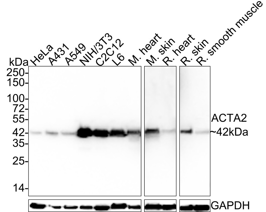 Western blot analysis of alpha smooth muscle Actin on different lysates with Rabbit anti-alpha smooth muscle Actin antibody (<a href="/products/ET1607-53" style="font-weight: bold;text-decoration: underline;">ET1607-53</a>) at 1/5,000 dilution.<br /><br />Lane 1: HeLa cell lysate<br />Lane 2: A431 cell lysate<br />Lane 3: A549 cell lysate<br />Lane 4: NIH/3T3 cell lysate<br />Lane 5: C2C12 cell lysate<br />Lane 6: L6 cell lysate<br />Lane 7: Mouse heart tissue lysate<br />Lane 8: Mouse skin tissue lysate<br />Lane 9: Rat heart tissue lysate<br />Lane 10: Rat skin tissue lysate<br />Lane 11: Rat smooth muscle tissue lysate<br /><br />Lysates/proteins at 20 µg/Lane.<br /><br />Predicted band size: 42 kDa<br />Observed band size: 42 kDa<br /><br />Exposure time: 5 seconds;<br /><br />4-20% SDS-PAGE gel.<br /><br />Proteins were transferred to a PVDF membrane and blocked with 5% NFDM/TBST for 1 hour at room temperature. The primary antibody (<a href="/products/ET1607-53" style="font-weight: bold;text-decoration: underline;">ET1607-53</a>) at 1/5,000 dilution was used in 5% NFDM/TBST at room temperature for 2 hours. Goat Anti-Rabbit IgG - HRP Secondary Antibody (<a href="/products/HA1001" style="font-weight: bold;text-decoration: underline;">HA1001</a>) at 1:100,000 dilution was used for 1 hour at room temperature.