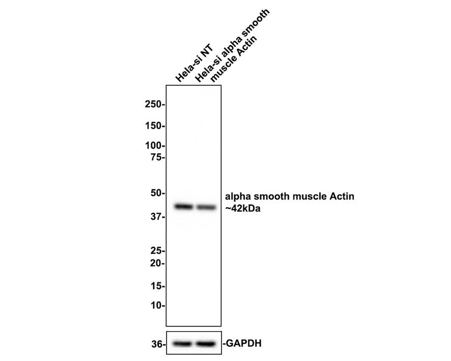 Western blot analysis of alpha smooth muscle Actin on different lysates with Rabbit anti-alpha smooth muscle Actin antibody (<a href="/products/ET1607-53" style="font-weight: bold;text-decoration: underline;">ET1607-53</a>) at 1/1,000 dilution.<br /><br />Lane 1: Hela-si NT cell lysate<br />Lane 2: Hela-si alpha smooth muscle Actin cell lysate<br /><br />Lysates/proteins at 10 µg/Lane.<br /><br />Predicted band size: 42 kDa<br />Observed band size: 42 kDa<br /><br />Exposure time: 5 seconds;<br /><br />4-20% SDS-PAGE gel.<br /><br />ET1607-53 was shown to specifically react with alpha smooth muscle Actin in Hela-si NT cells. Weakened band was observed when Hela-si alpha smooth muscle Actin sample was tested. Hela-si NT and Hela-si alpha smooth muscle Actin samples were subjected to SDS-PAGE. Proteins were transferred to a PVDF membrane and blocked with 5% NFDM in TBST for 1 hour at room temperature. The primary antibody (<a href="/products/ET1607-53" style="font-weight: bold;text-decoration: underline;">ET1607-53</a>, 1/1,000) and Loading control antibody (Rabbit anti-GAPDH, <a href="/products/ET1601-4" style="font-weight: bold;text-decoration: underline;">ET1601-4</a>, 1/10,000) were used in 5% BSA at room temperature for 2 hours. Goat Anti-rabbit IgG-HRP Secondary Antibody (<a href="/products/HA1001" style="font-weight: bold;text-decoration: underline;">HA1001</a>) at 1:100,000 dilution was used for 1 hour at room temperature.